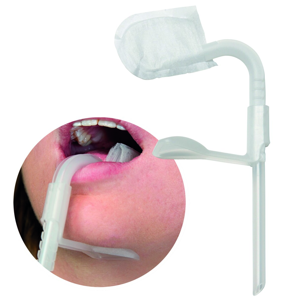 Lingua Fix - lot de 10- 50Z953S - Zirc