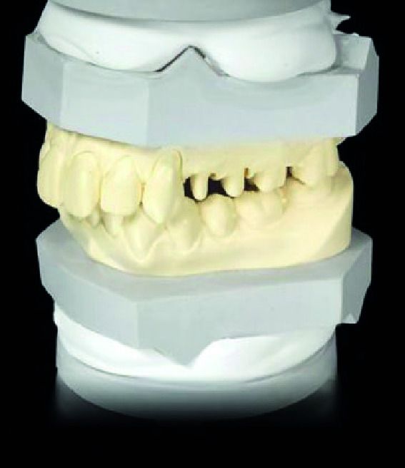 Sheraarti-Quick Blanc SHERA - Le carton de 20kg