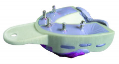 Miratrays Implant HAGER & WERKEN - Supérieur Moyen - Lot de 6