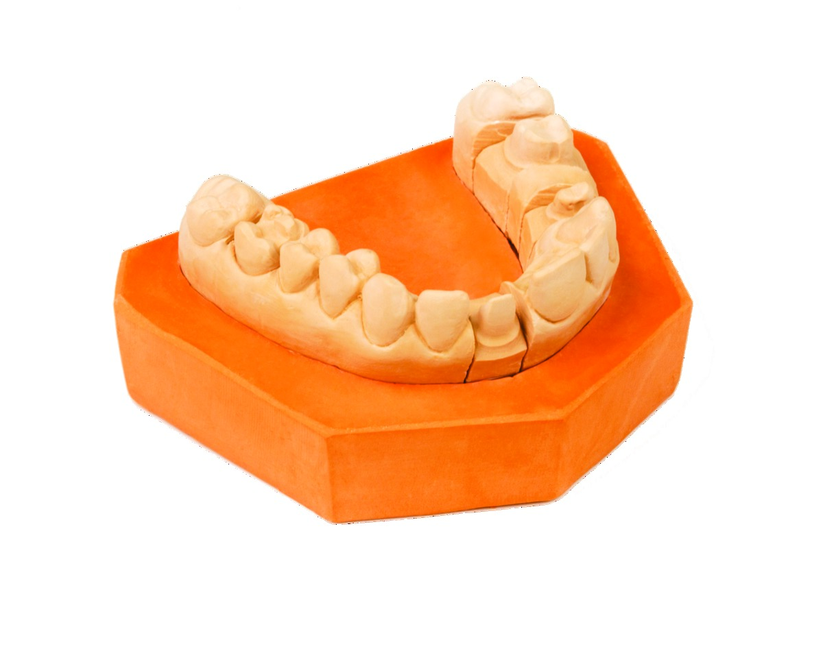 Plâtre Kimberlit PROTECHNO - Le carton de 12 kg (6 x 2 kg)