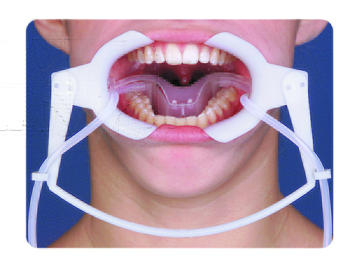 Ecarteur Nola large - 300401 - ORTHO TECHNOLOGY Ecarteur Nola large - 300401 - ORTHO TECHNOLOGY