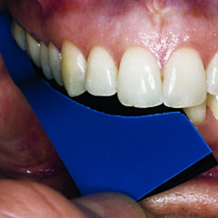 TrollFoil Mini bleu (100 pièces) Directa Dental