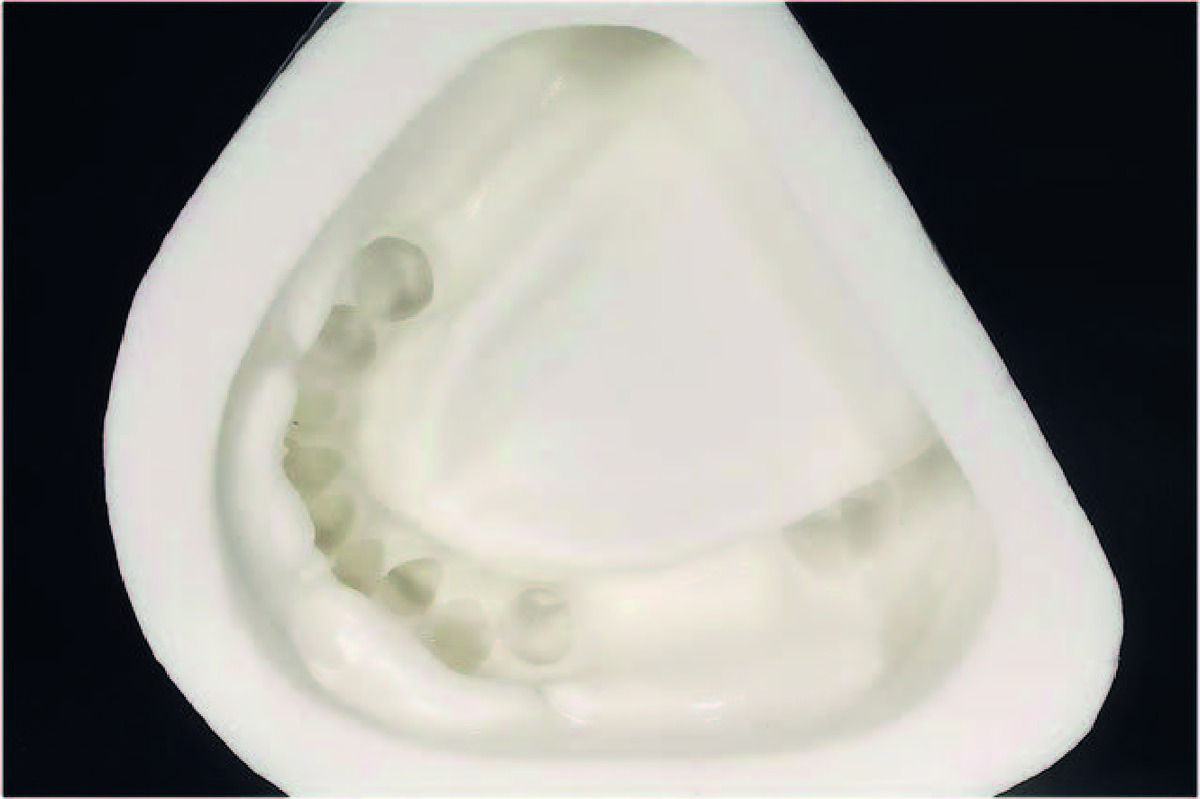 Sheraform Gel SHERA - Le seau de 6 kg