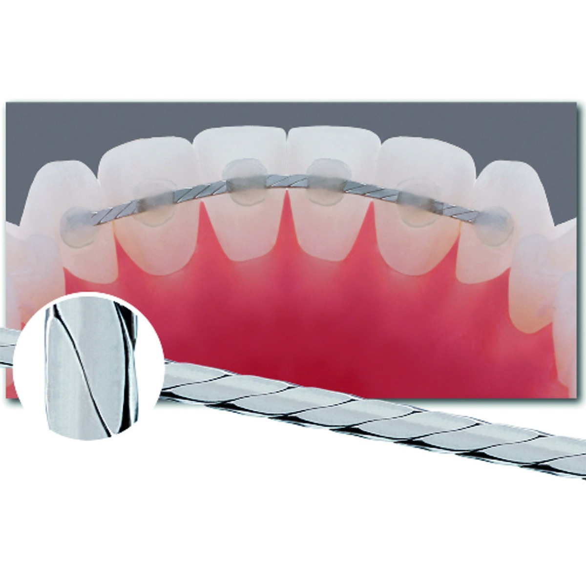 Fil de contention tressé ORTHO-TECHNOLOGY - Boîte de 10 Fil de contention tressé ORTHO-TECHNOLOGY - Boîte de 10
